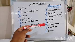 Cerebellar Disease  Signs and Aetiologies [upl. by Vonni]