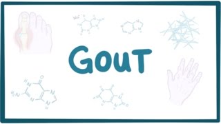 Gout  causes symptoms diagnosis treatment pathology [upl. by Nyrak71]