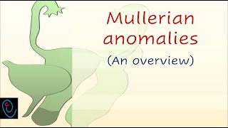 Mullerian anomalies  an overview [upl. by Mic]