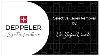 Selective Carious Tissue Removal  Deppeler x Dr Daniele Caries Treatment Kit [upl. by Enybor532]