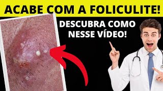 O MELHOR PRODUTO CONTRA FOLICULITE E PELOS ENCRAVADOS DESCUBRA QUAL É NESSE VÍDEO [upl. by Swetlana]