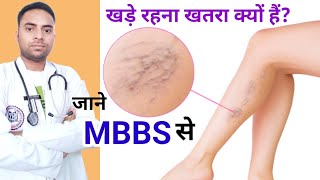 खड़े रहना खतरा क्यों होता हैं whats varicose vein disease varicoseveinanatomy raheesansari [upl. by Nyar]