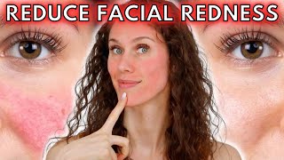 🔴 5 Reasons Your Face Is Always Red Rosacea to Dermatographia amp Everything Inbetween [upl. by Pugh618]