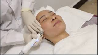 Operation video for oxygen facial machine [upl. by Russian]