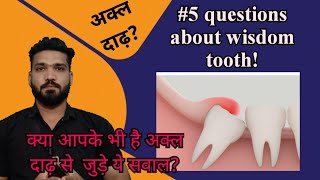 5 questions about wisdom tooth [upl. by Gabrielle103]