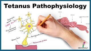 Tetanus Pathophysiology Mechanism of Action [upl. by Leumek]