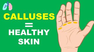 Why do we get calluses [upl. by Ejroj]