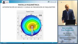 DR CARLOS MARTÍN CALVO QUERATOCONOS CON PENTACAM [upl. by Hsekar]