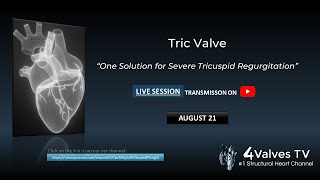 TricValve  quotOne Solution for Severe Tricuspid Regurgitationquot  Live Session [upl. by Berky]