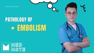 Embolism  Pathology [upl. by Yrehcaz]