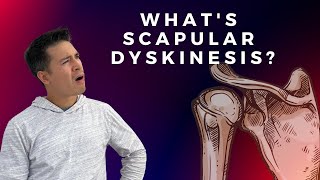 Scapular Dyskinesis and Shoulder Pain [upl. by Atekihc204]