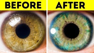 7 Things That Can Change Your Eye Color [upl. by Nivej]