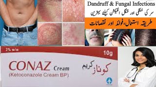 conaz cream uses in Urdu  conaz lation  conaz lation shampoo benefits in Urdu mishalkhanofficial [upl. by Gnirol]