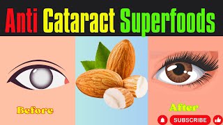 Prevent Cataract surgeryTop 7 superfoods to slow down cataract Top 5 eye exercises [upl. by Eliza197]