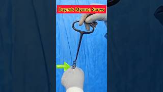 Doyens Myoma Screwmyomectomyobstetricsandgynecology [upl. by Einnij]