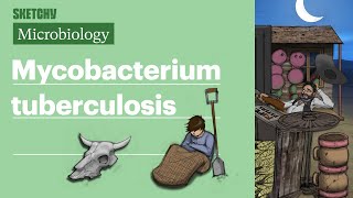 Mycobacterium Tuberculosis Microbiology  USMLE Step 1  Sketchy Medical [upl. by Trepur232]