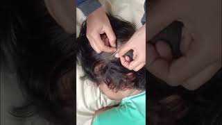 Scalp Searching ASMR for Sleep Intense Tingle Session [upl. by Maag]