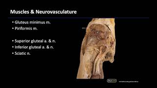 Gluteal Region  M1 Dissection Supplement [upl. by Sivartal629]