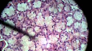 Mucus Acini Glanduar Epithelium [upl. by Durant]