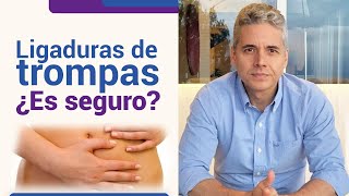 ¿Qué tan segura es la ligadura de trompas l Dr Juan Luis Giraldo [upl. by Raul449]