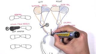 Visual Pathway and Lesions [upl. by Keviv]