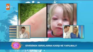 Sivrisinek ısırıklarına karşı ne yapmalı  Sağlıklı Mutlu Huzurlu 138 Bölüm  atv [upl. by Otiragram945]