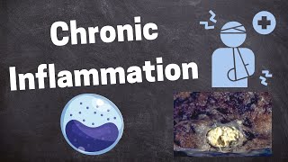 Pathology of Chronic Inflammation [upl. by Rosenberg]