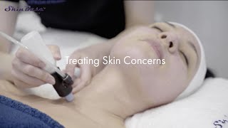 Treating skin concerns with SkinBase microdermabrasion [upl. by Leann]