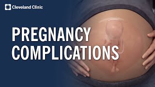 Common Pregnancy Complications Explained [upl. by Sybyl]