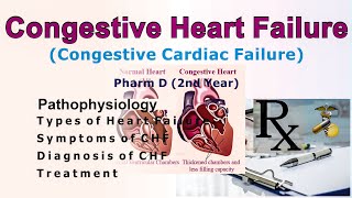 Congestive cardiac failure [upl. by Illehs]