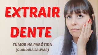 Extrair dente  tumor na parótida [upl. by Koa797]