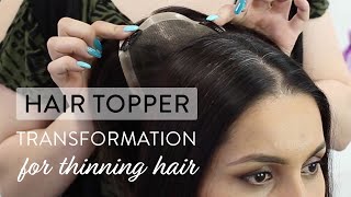 Hair Topper Transformation for Thinning Hair [upl. by Davide]