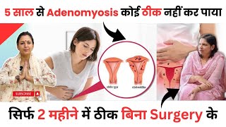 Adenomyosis Symptoms amp Treatments Hindi  Adenomyosis treatment without Surgery  Dr Upasana Vohra [upl. by Annairba]