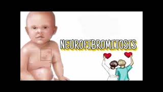 Neurofibromatosis History mrcpch Clinical [upl. by Easter]