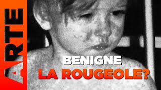 Des vaccins et des Hommes  Analyse  Épisode 4  La rougeole une maladie bénigne [upl. by Nwahshar]