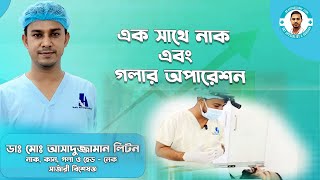 একইসাথে রোগীর নাক এবং গলার অপারেশন । Tonsillectomy। Septoplasty । Dr Assaduzzaman Liton [upl. by Gatias]