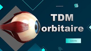 Bonne Pratique en Scanner TDM orbitaire [upl. by Adnam]