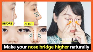 5 Best steps How to lift your nose bridge higher get perfect nose without surgery [upl. by Ytinav915]