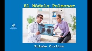 Nódulo Pulmonar no siempre es igual a Cáncer [upl. by Ahsenod]