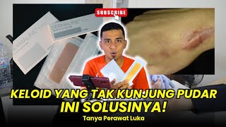 Rekomendasi Dresing Untuk Solusi Masalah Keloid Pada Kulit❗️ [upl. by Ennobe]