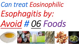 Eosinophilic esophagitis diet symptoms diagnosis treatment causes elimination diet [upl. by Beckman188]