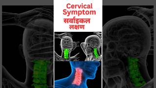 Cervical Symptoms  सर्वाइकल लक्षण  short Trending  By Medicated Subhash [upl. by Eikceb596]