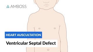 Ventricular Septal Defect VSD  Heart Auscultation  Episode 11 [upl. by Elocin]