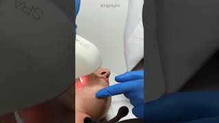 IPL Treatment Gimana Cara Kerjanya ipl shorts [upl. by Nylarej]