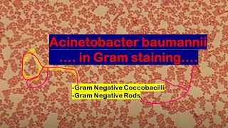 Acinetobacter baumannii in Gram Staining of Culture [upl. by Jennifer]