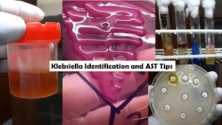 ESBL Producer XDR Strain Klebsiella pneumoniae isolation from Urine Culture and Sensitivity [upl. by Yecak219]