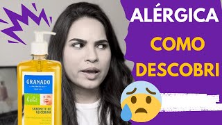 Alergia de SABONETE e SHAMPOO Como eu descobri [upl. by Simsar]