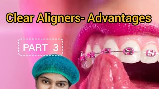 Clear aligners Invisalign advantages in tamil [upl. by Jew]