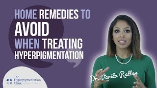 How to Treat Hyperpigmentation  Home Remedies  DO THEY WORK [upl. by Jayme]