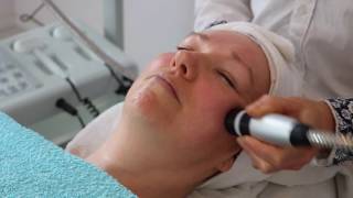 Naaldloze mesotherapie en elasticiteit huid herstellen [upl. by Anaya]